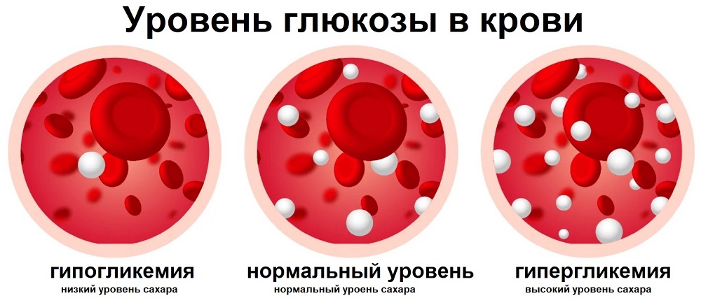 Уровень глюкозы в крови