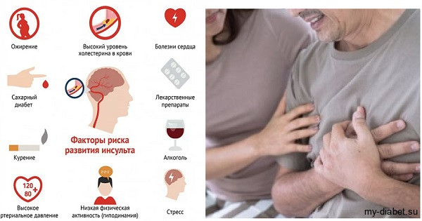 Инсульт при сахарном диабете