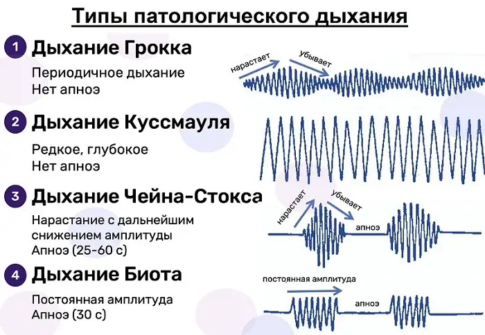 Типы патологического дыхания