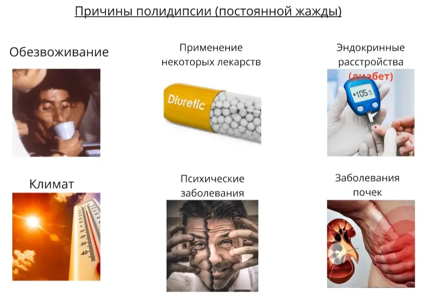 Причины полидипсии