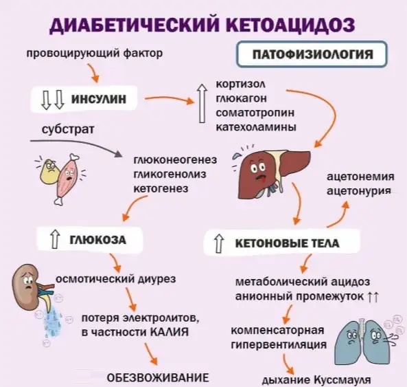 Диабетический кетоацидоз. Симптомы