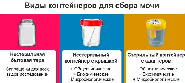 Виды контейнеров для сбора мочи