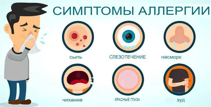 Симптомы аллергии
