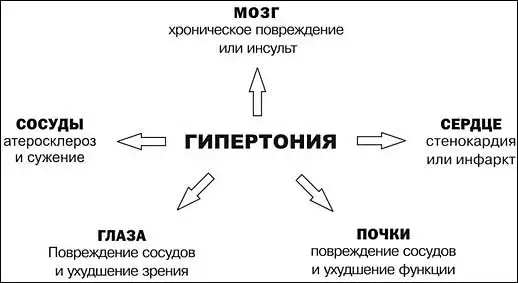 Влияние гипертонии на органы человека